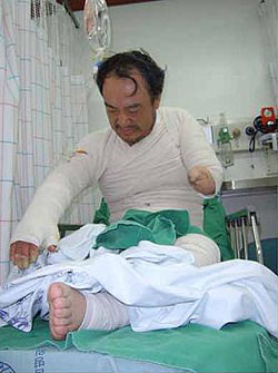 부천지역 장애인노점상 분신기도 잇따라