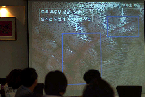 국과수, “하중근 씨 넘어지며 머리다쳐 사망”