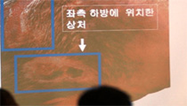 故하중근 열사 직접 사인, ‘소화기 가격’으로 추정