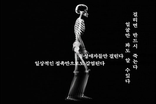 [현장속으로] [특집 HIV/AIDS – 1부] 말할게 있수다