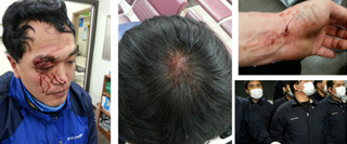 대선 끝나자마자…현대차 용역 공장투입, 노조원 17명 부상