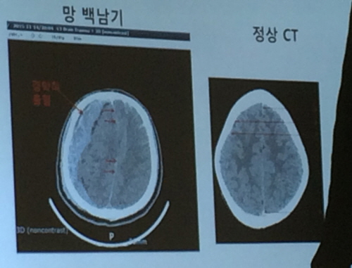 백남기 농민 사고 직후 CT 공개…사망진단서 조작 의혹 공개질의